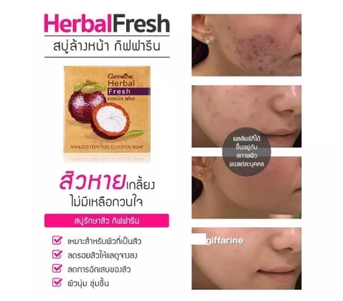 สบู่มังคุด กิฟฟารีน สบู่เปลือกมังคุด ลดสิวที่หลัง สบู่เปลือกมังคุดลดสิว ผิวเนียนนุ่ม อ่อนโยน ของแท้ 100%"